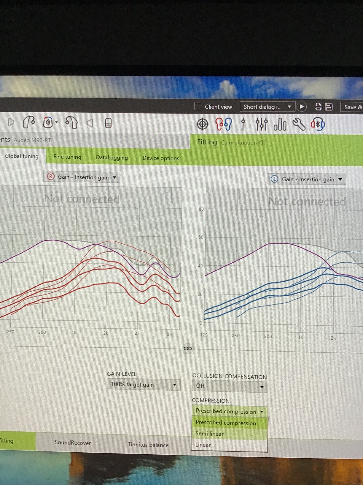 Does the Phonak programming software still have settings for