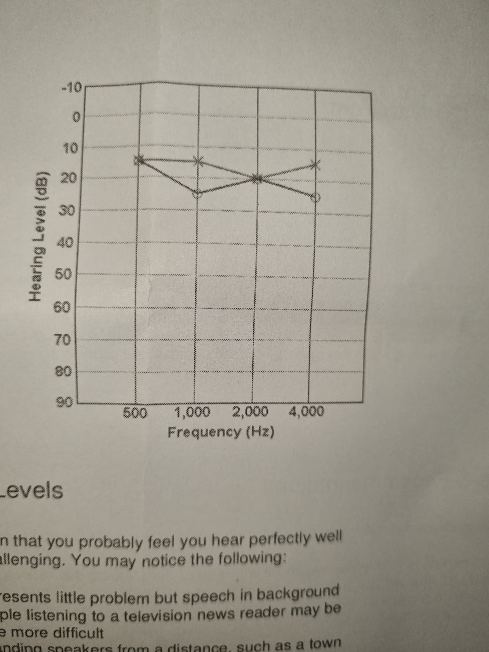 Hearing Test Result Hearing Loss Hearing Aid Forum Active Hearing