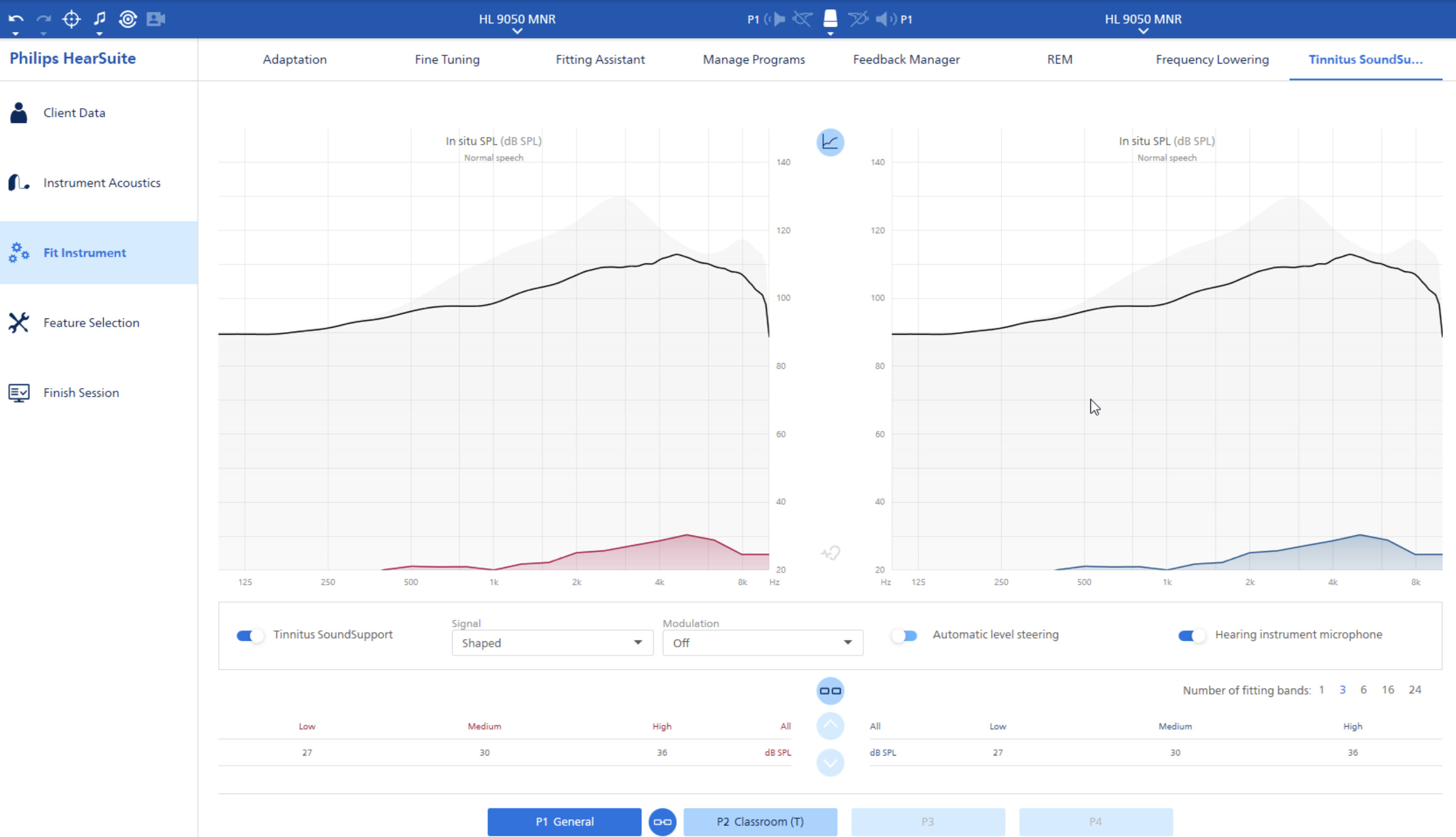 Philips HearLink 9050 to hit Costco soon? With similar tech to Oticon