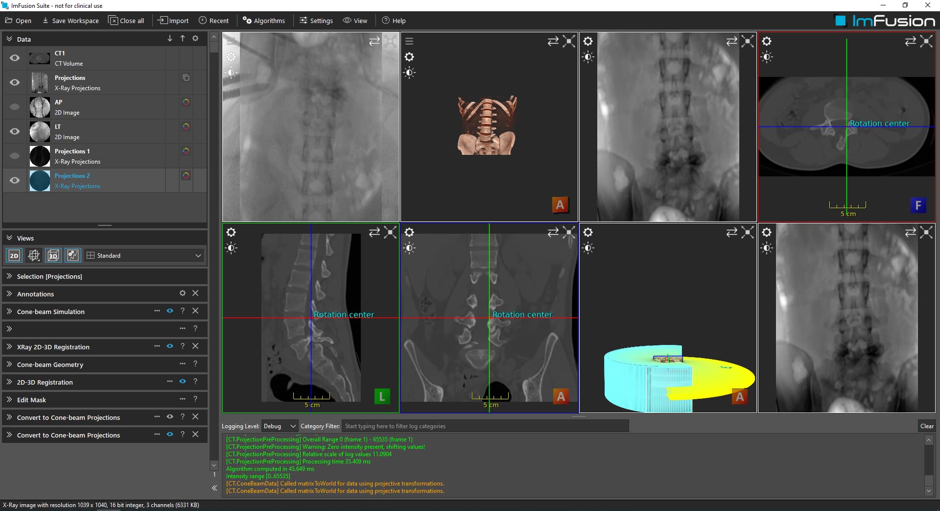 XRay 2D3D Registration (How to register and fusion the Image) Xray