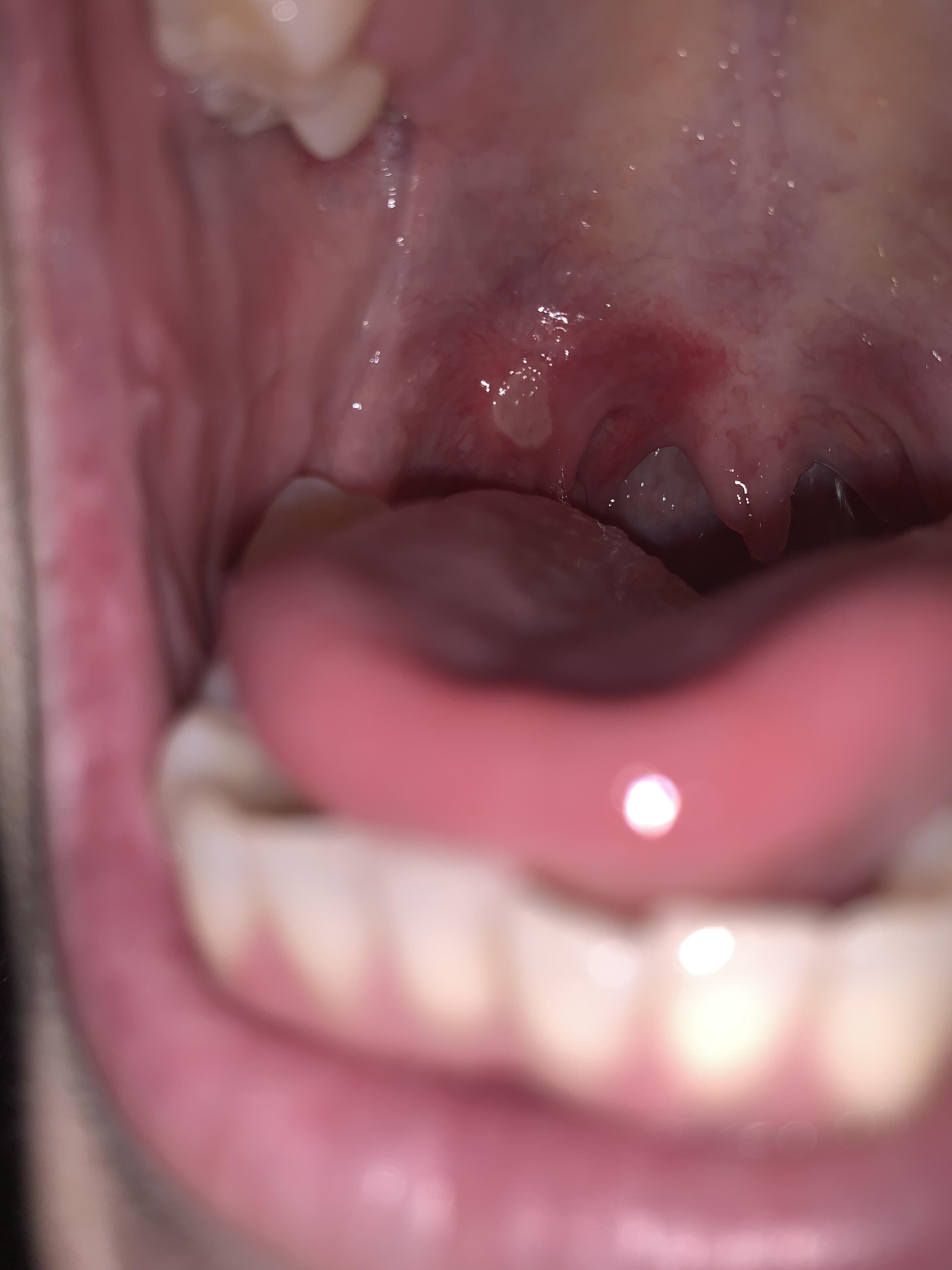 Er dette bare en diger afte? Kropp og helse Kvinneguiden Forum