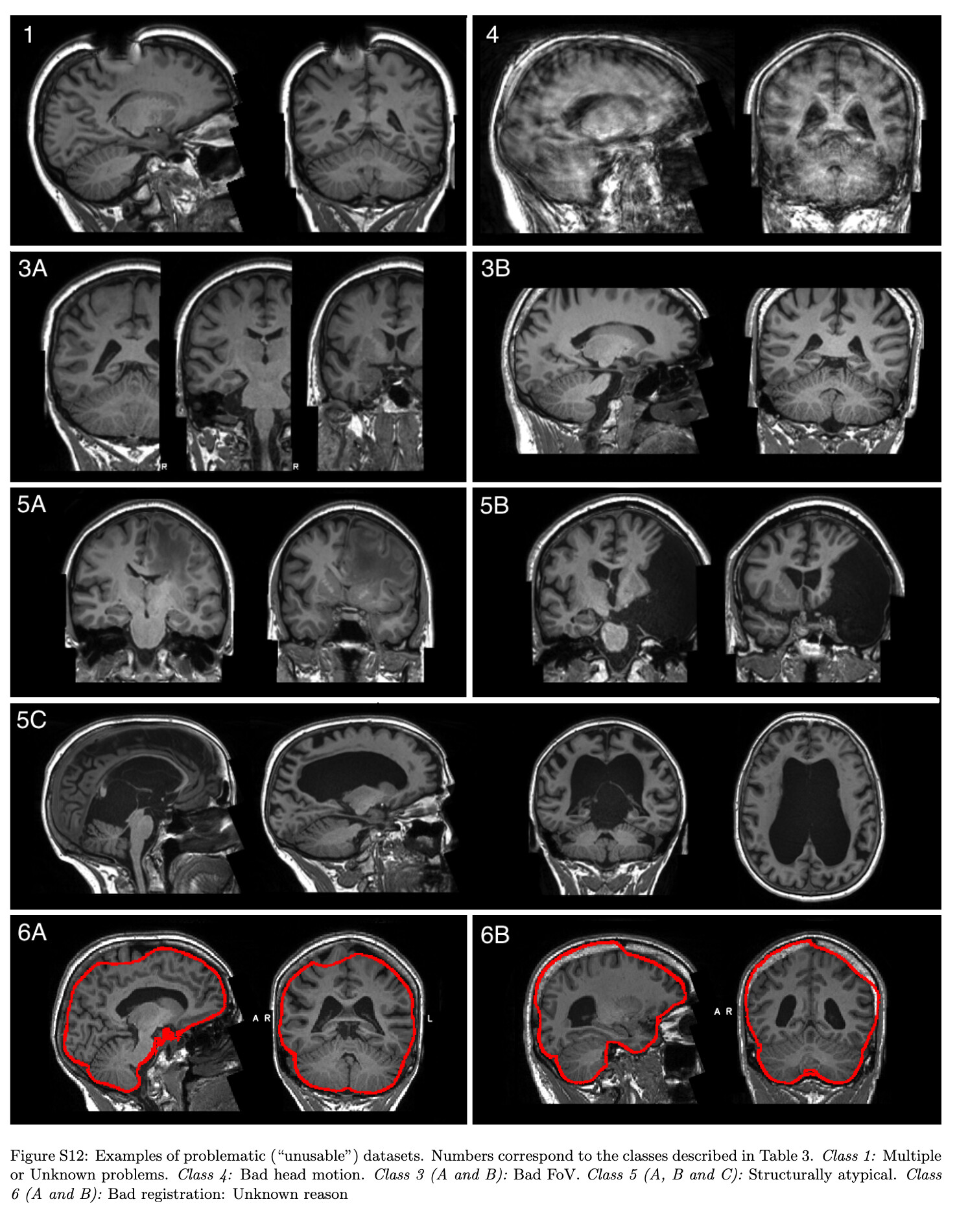 MRI Quality Control Deep Learning fast.ai Course Forums