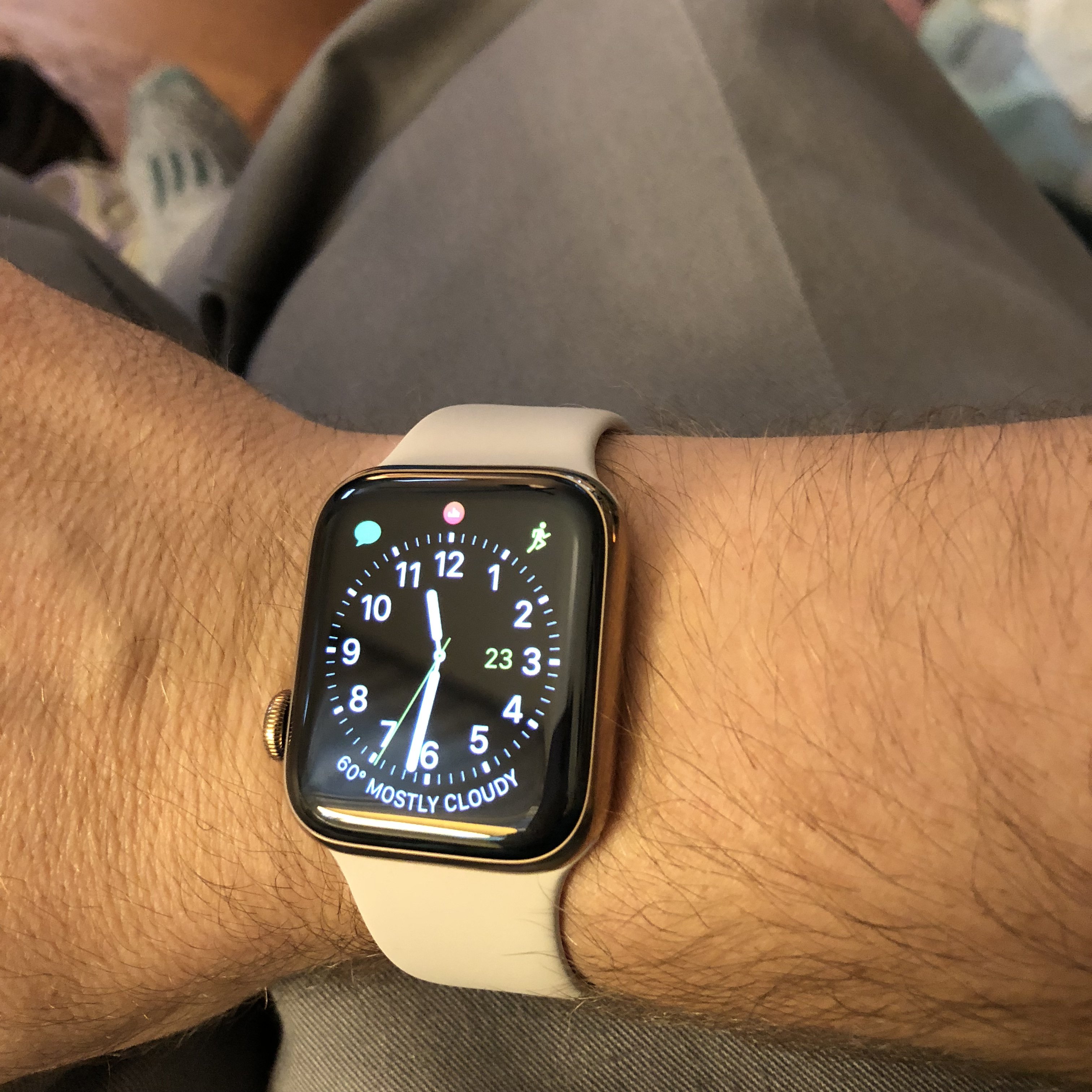 Pictures of the 40mm on the wrist MacRumors Forums