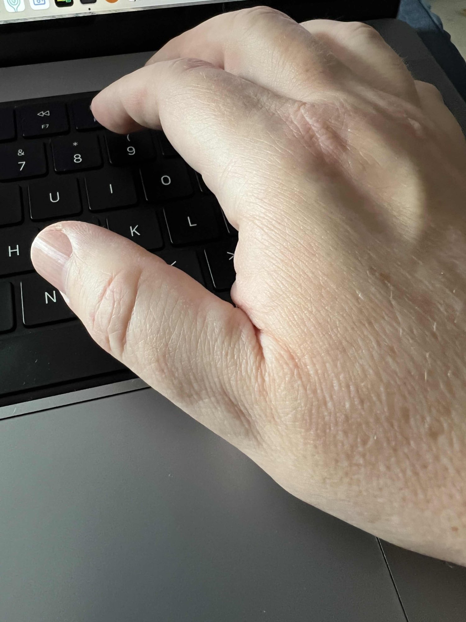 16in MBP and accidentally touching trackpad while typing MacRumors Forums