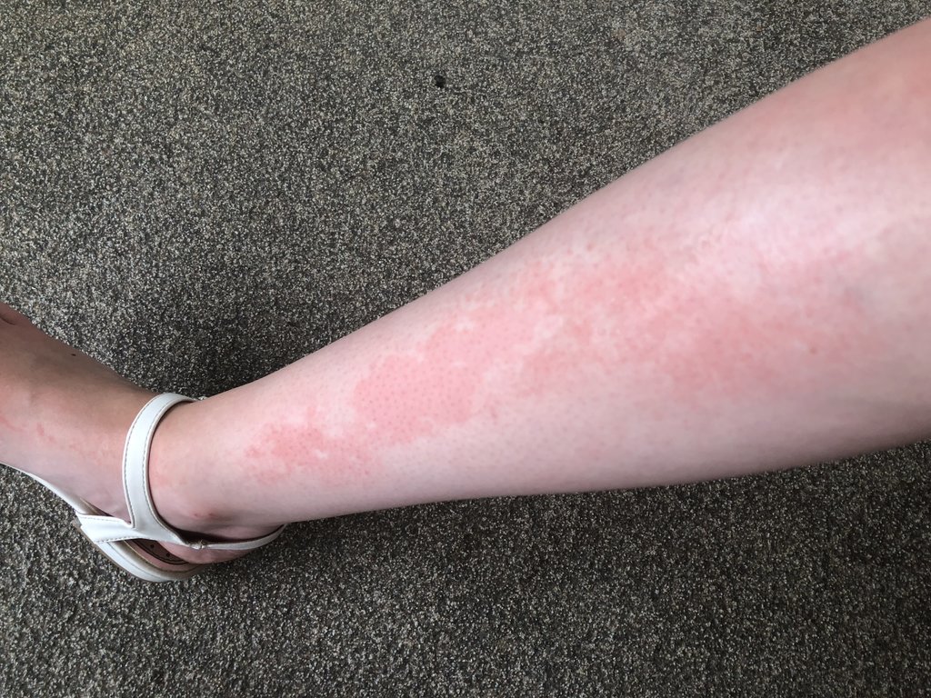 Trip Report 21st, a first timer, stuck on tower of