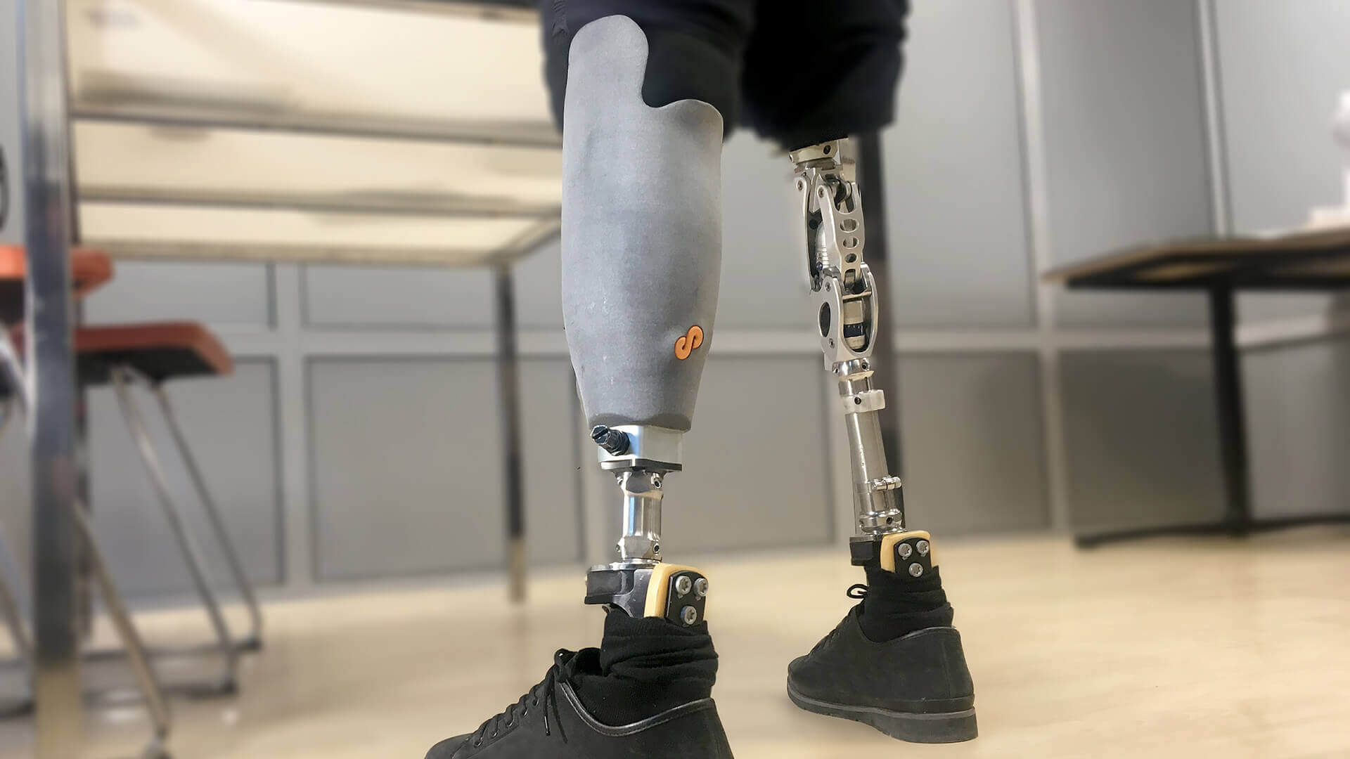 Medical Industry Prosthetic socket BASF FORWARD AM