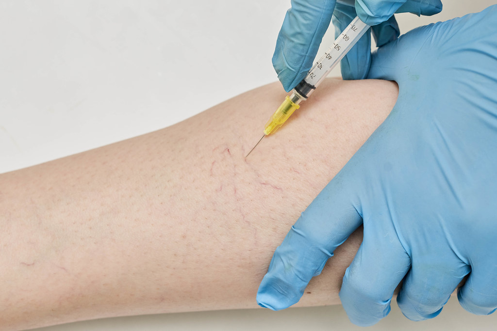 Compression Hosiery. Medical Compression stockings and tights for