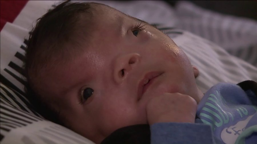 ‘God’s little miracle’ Baby boy born with oneofakind