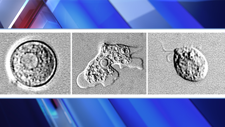Braineating amoeba found at unusually high levels at water park Fox 59