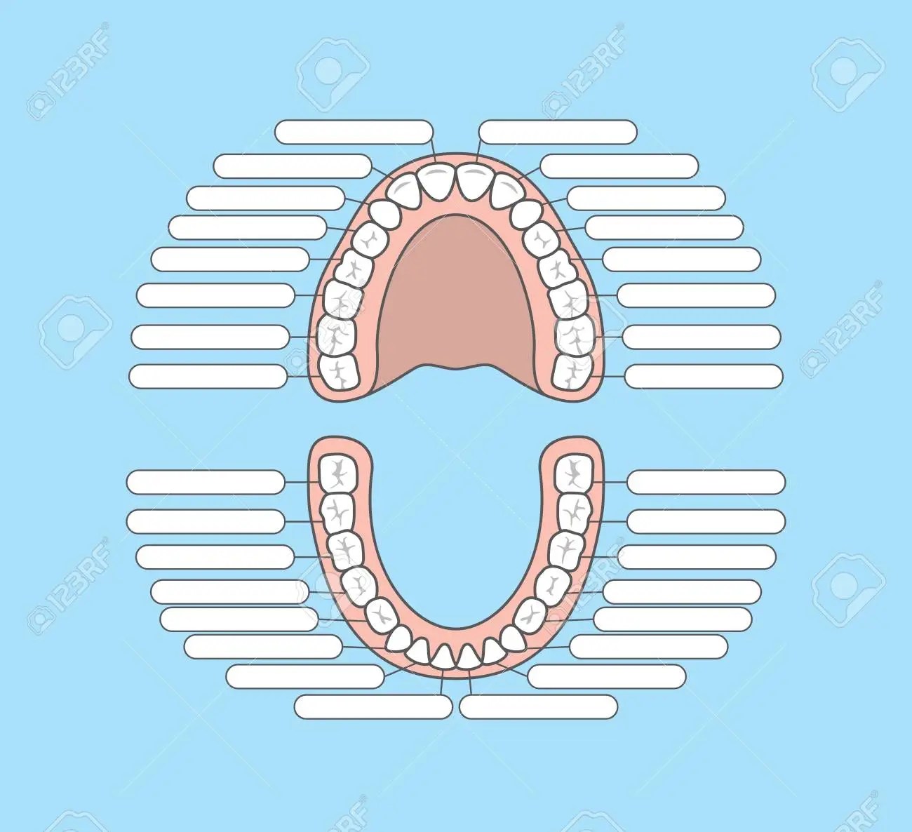 Why do permanent retainers break?