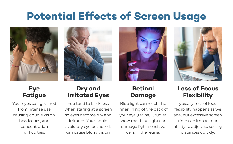 product description global Foxman Frames