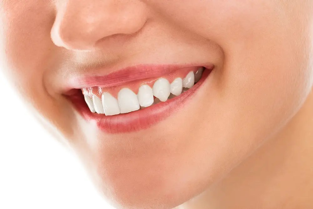 Why Teeth Whitening is important. Benefits of Teeth Whitening. First