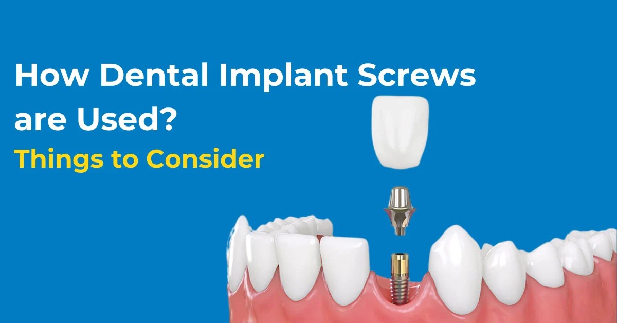 How Dental Implant Screws are Used? Things to Consider Franklin