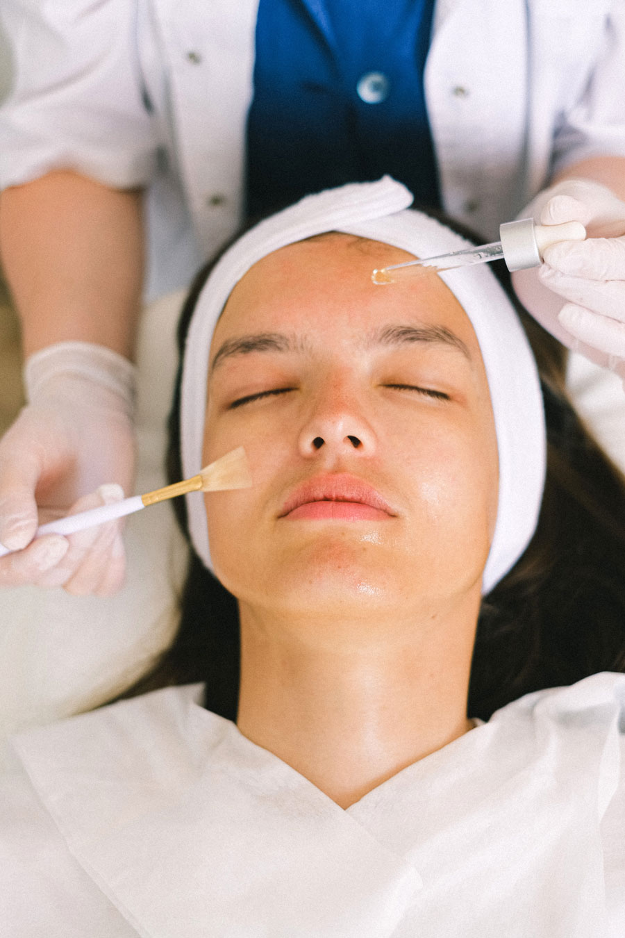 Melanx Chemical Peel Near Me at Tressie Markley blog