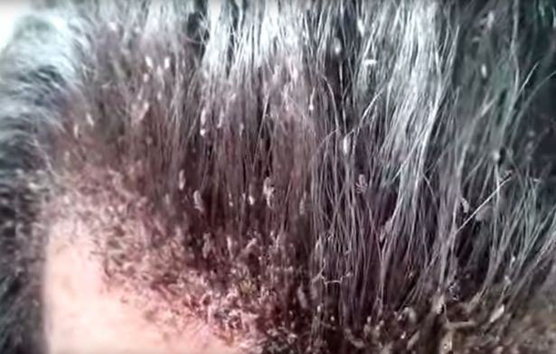 Keith Raniere Has Head Lice Had Hair Shorn Off Frank Report
