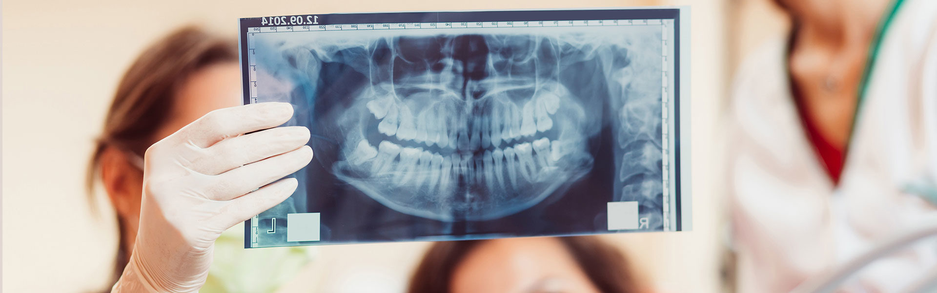 Dental Digital X Rays in Tucson, AZ Near You Frank Son DDS