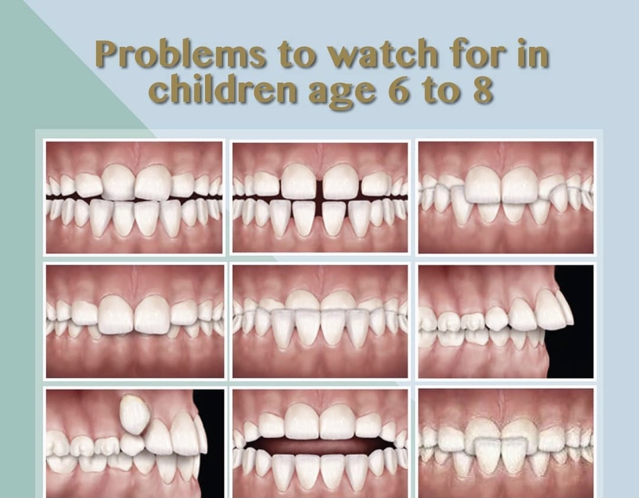 Children's Braces Frazer Dental