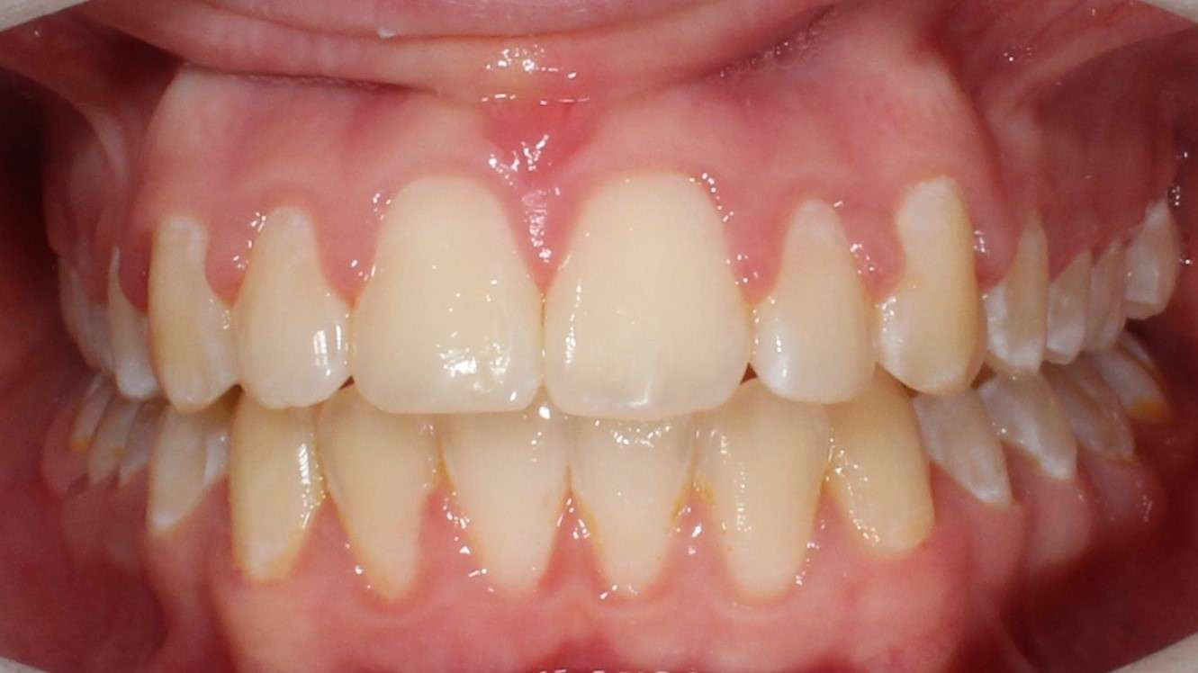 Case Study 20 Frederick Orthodontic Clinic Drogheda