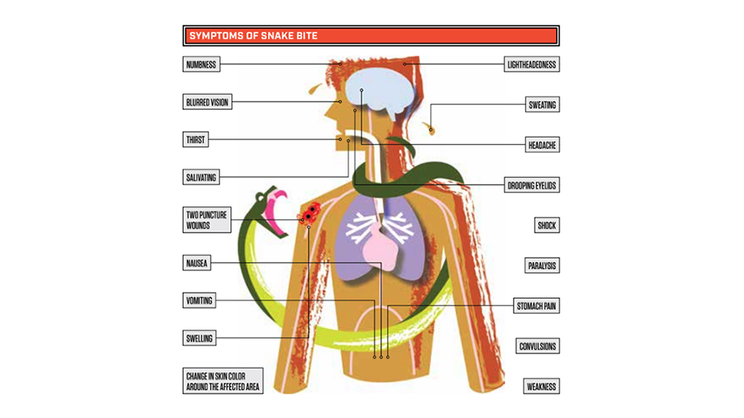 Snake Bite 101 The Effects of Venom & How To Treat a Snake Bite