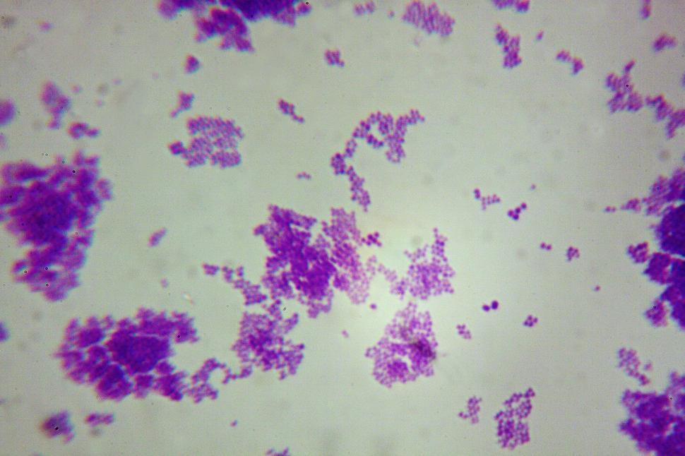Staphylococcus Aureus Under A Microscope