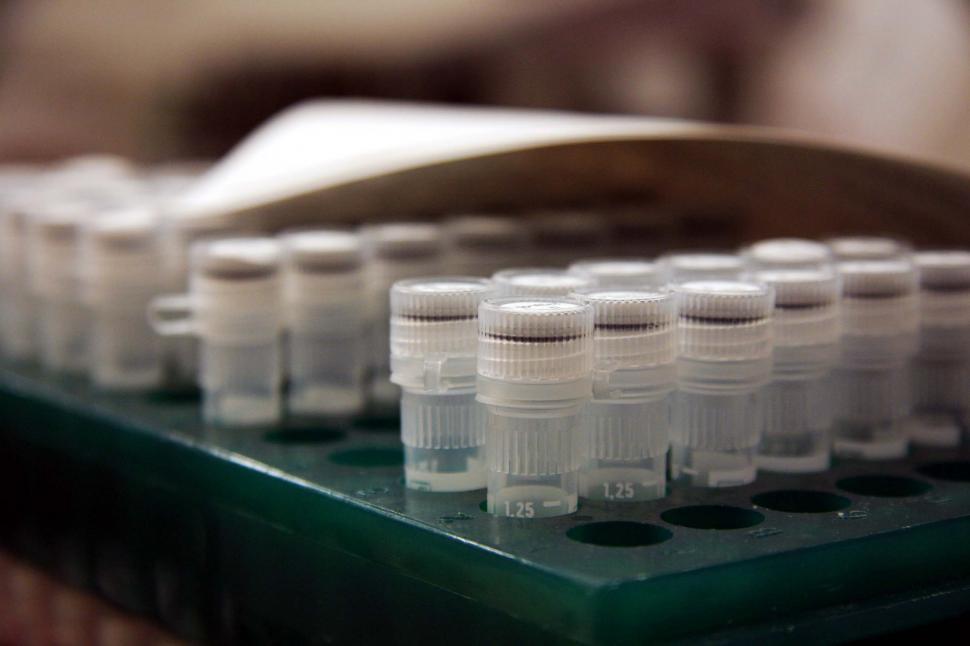Free Stock Photo of DNA samples Download Free Images and Free Illustrations