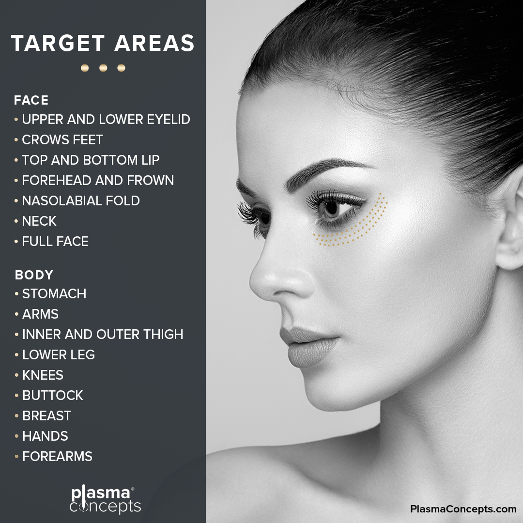 What Is a Plasma Pen and What Does It Do?