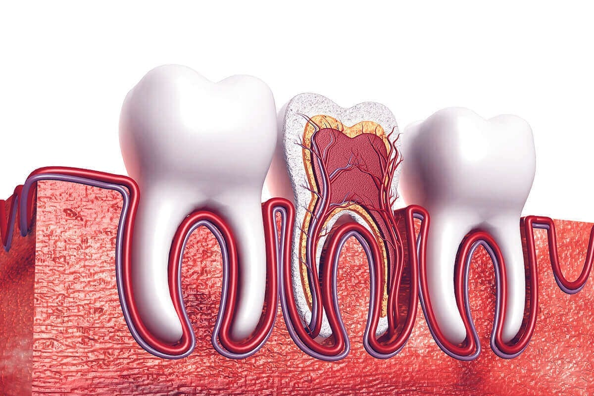 Root Canal Treatment FRESH Dental NC Your Local Dentist