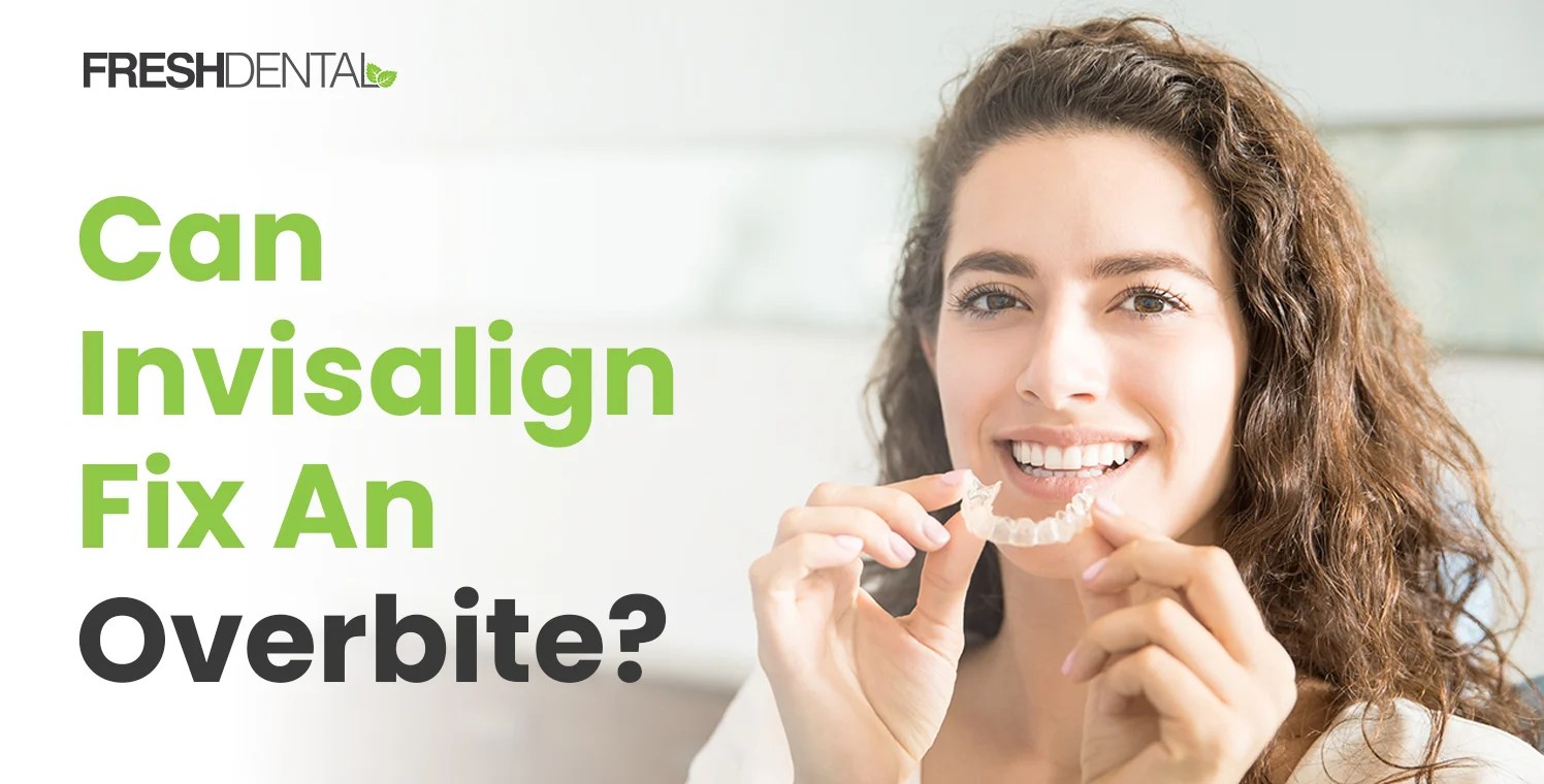 Can Invisalign Fix An Overbite?