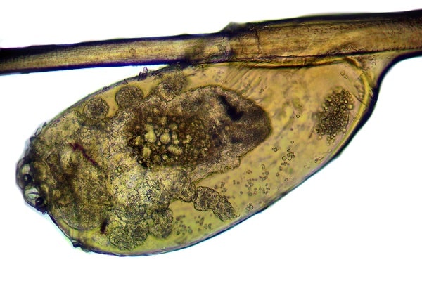 Flea Eggs Under Microscope / View under the microscope of Butterfly