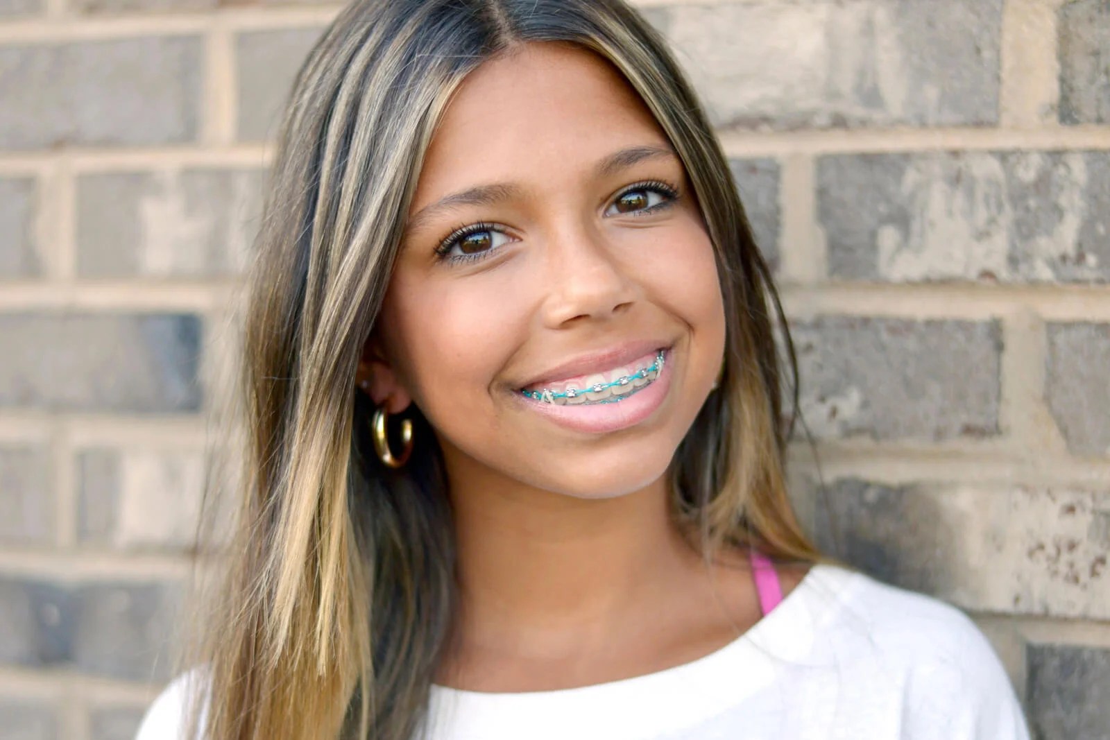 Cost of Braces Fritz & Wilson Orthodontics
