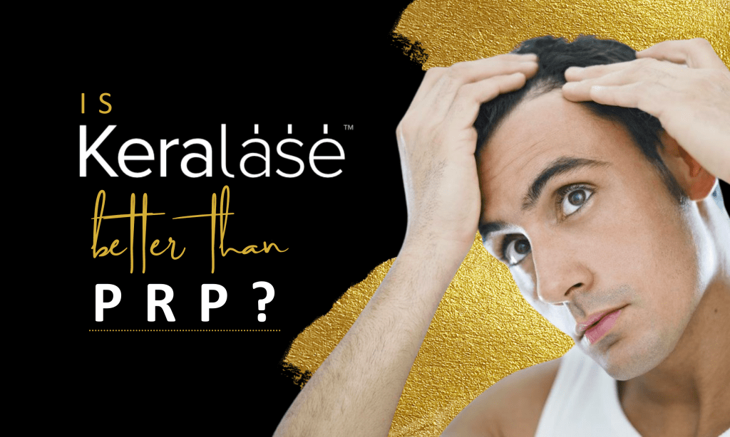 Why KeraLase is Better Than PRP for Hair Restoration