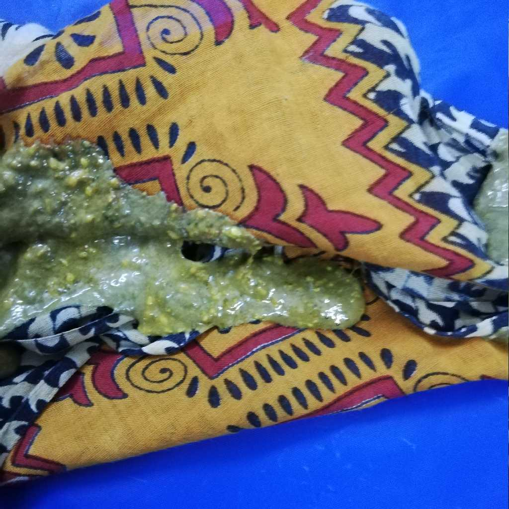 my lo has been having green poop since his 2nd month vaccination. is it