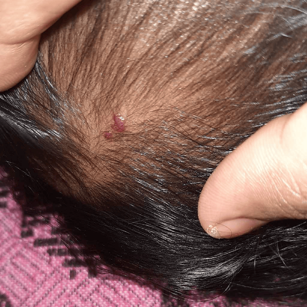 AskTheExpert hello sir, my 3 months old baby girl has red swollen