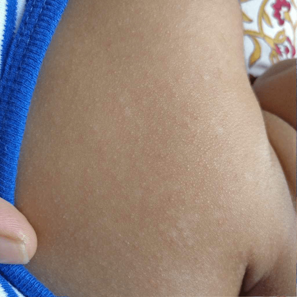 Hello! My 4 month old baby got some white spots on his