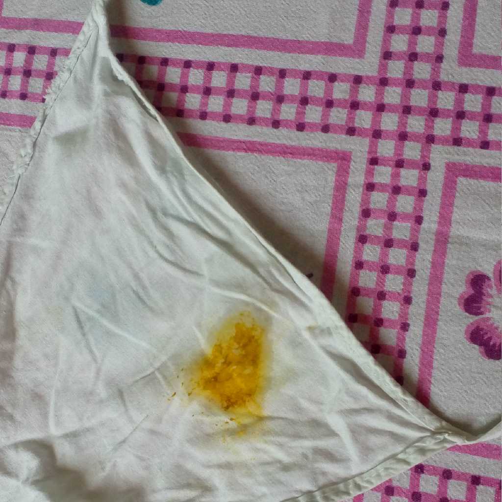 l doctor I have applied propyderm nf cream to my 2month baby as she has rashes became ref near