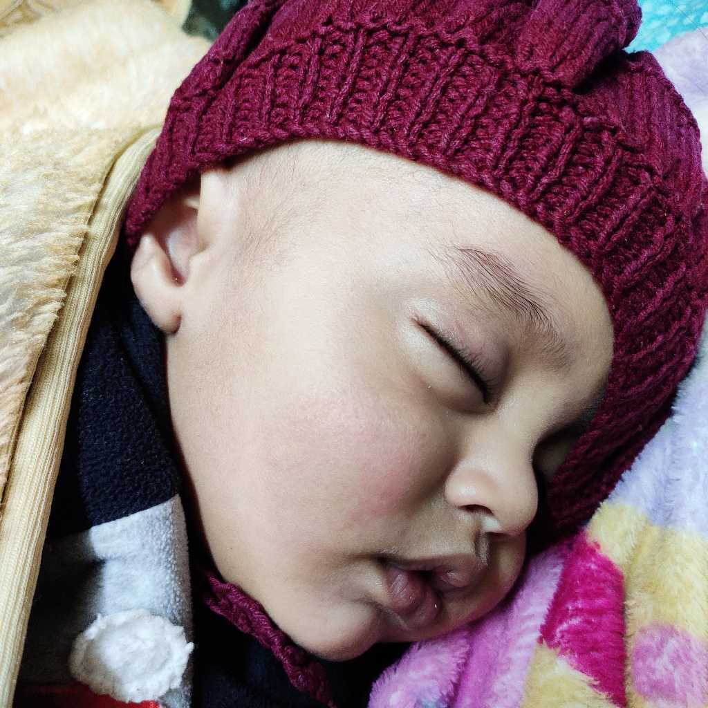 Suddenly today i found a dry red patch on my baby's cheek, i m vry