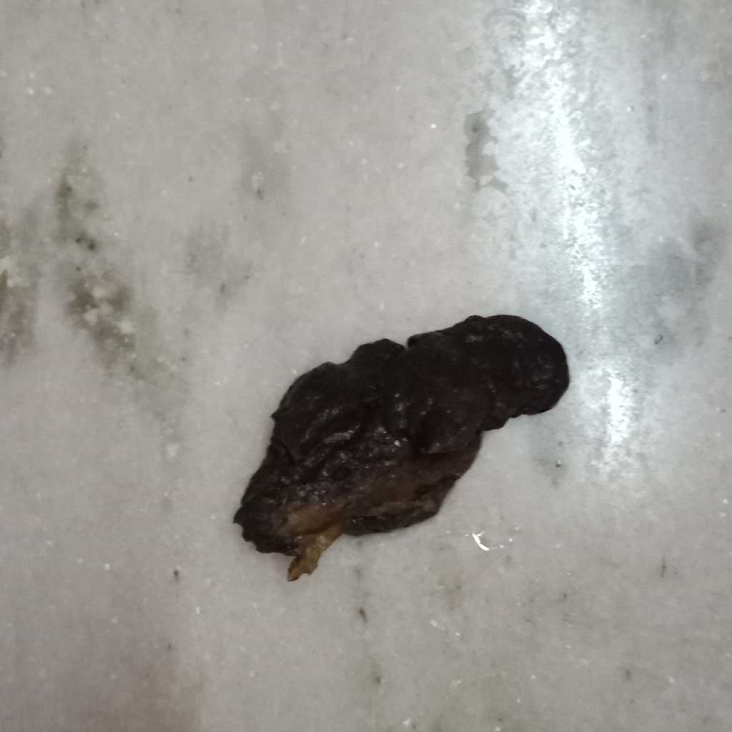 my baby is passing black stool from last three days. is that fine