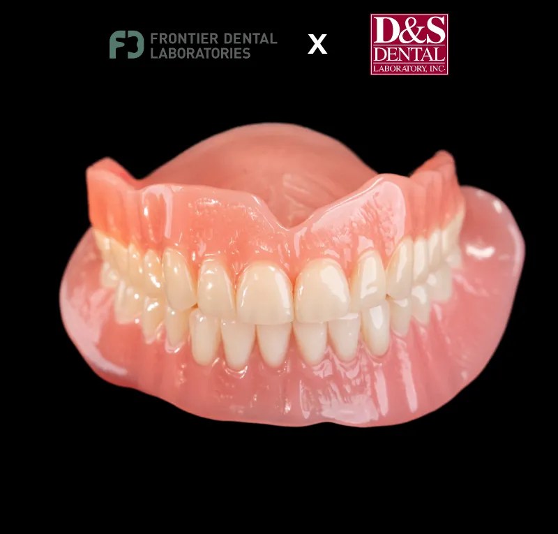 Digital Dentures Frontier Dental Laboratories