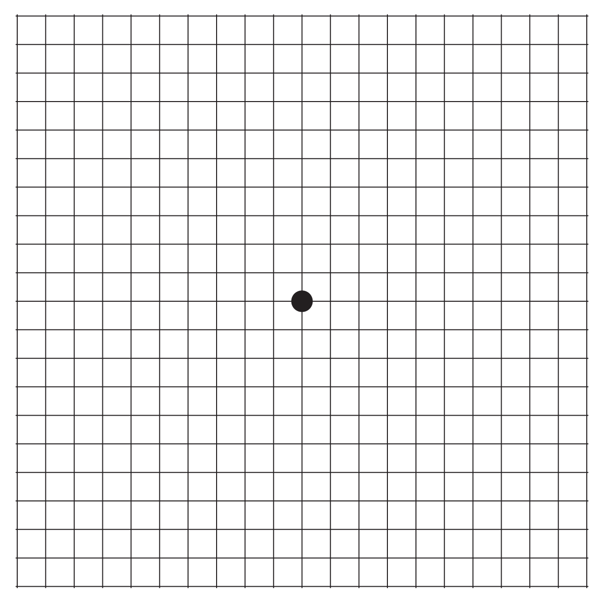 How to use an Amsler Grid Front Range Retina