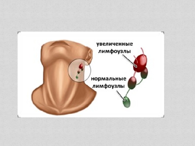 Презентация к уроку "Движение лимфы"