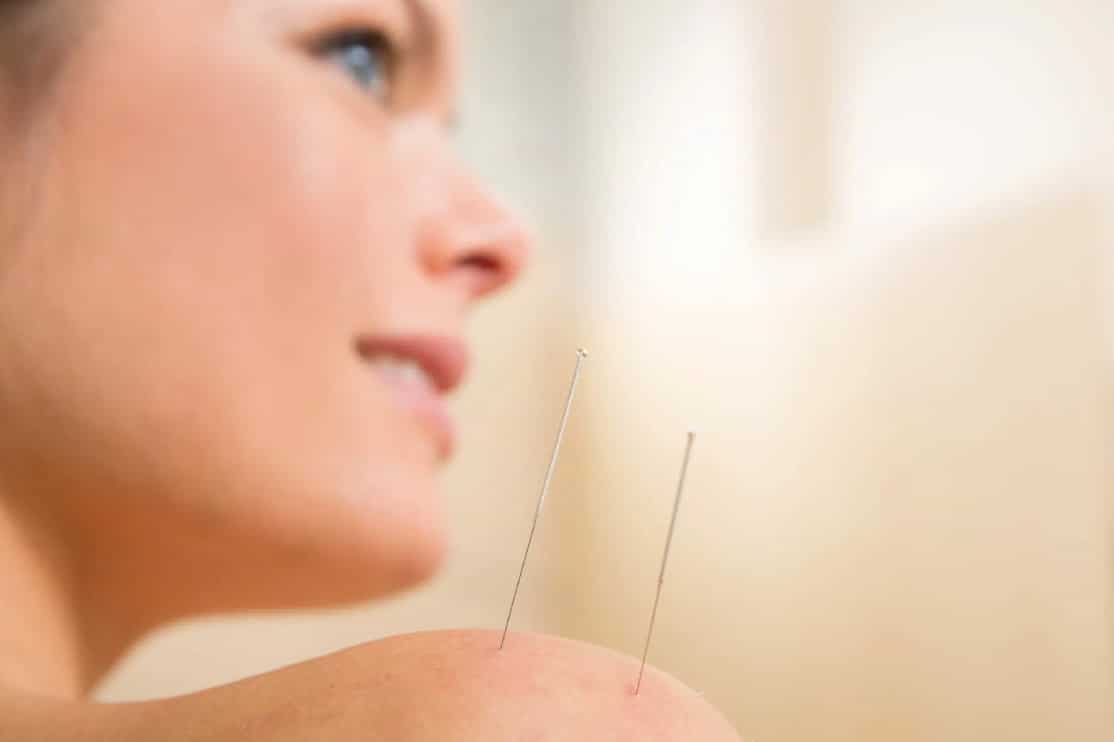 How Acupuncture Can Help Combat Opioid Addiction FTX Wellness & Performance