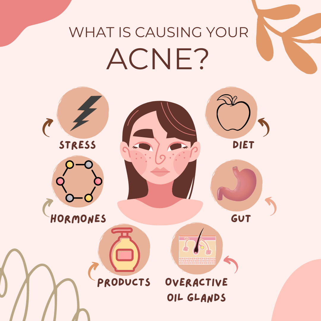What is Causing Your Acne? Functional Fueling Nutrition
