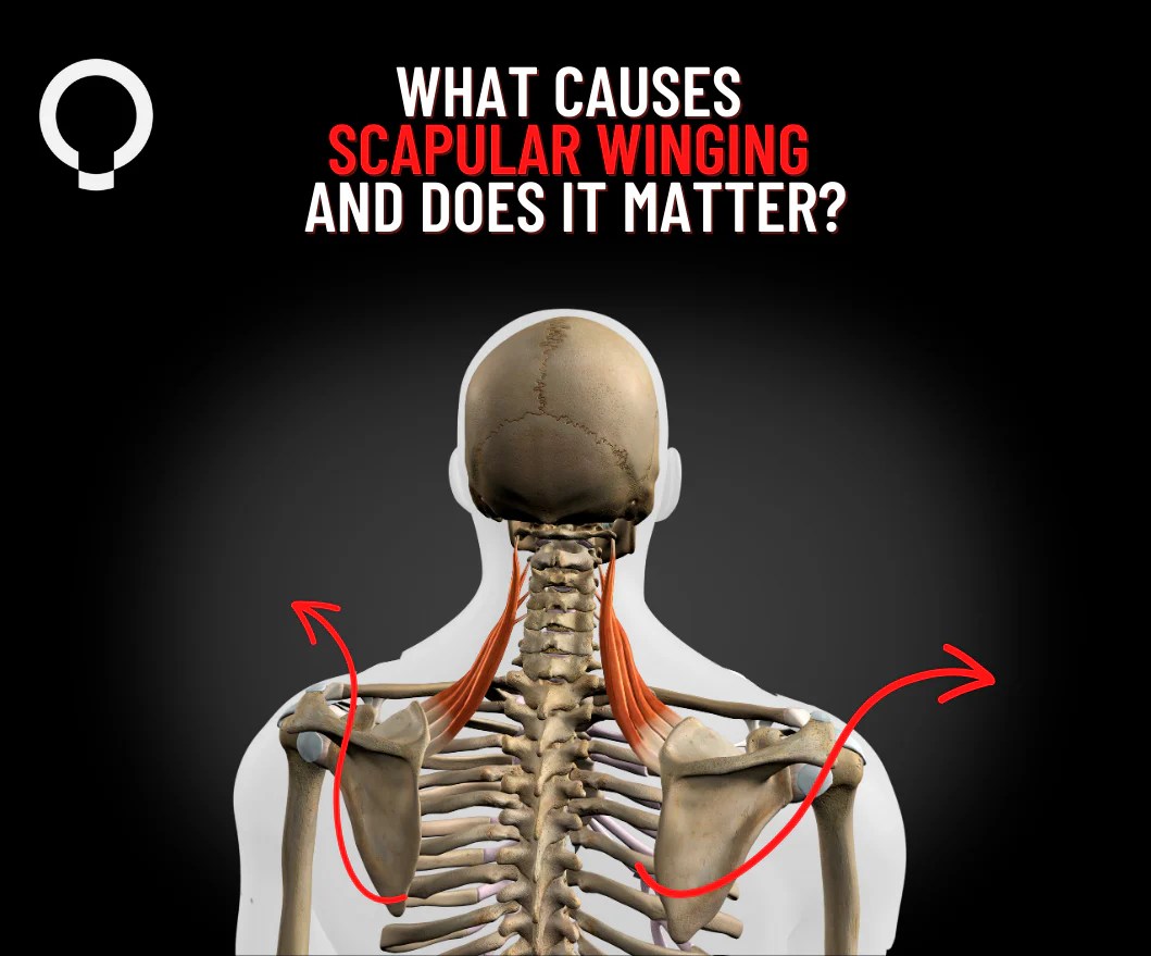 What Causes Scapular Winging and Does It Matter? Functional Patterns