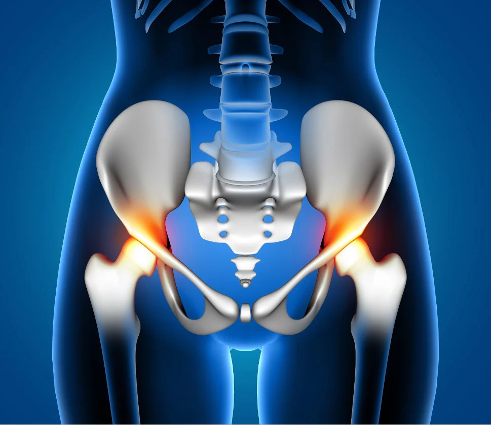 A Functional Approach to Hip Issues in Adults – Functional Patterns