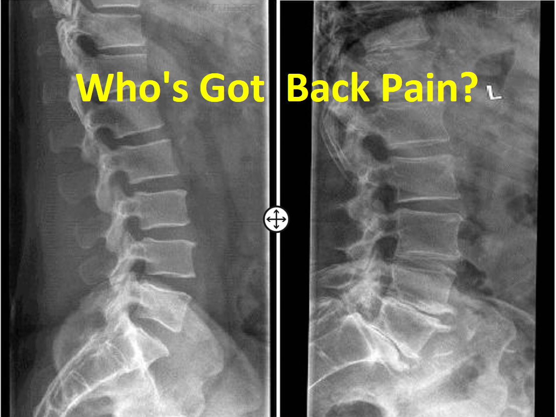 Back Pain Hits Cork! Penrose Wharf, Cork City