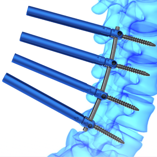 Fuse PSS Pedicle Screw System Fuse Medical