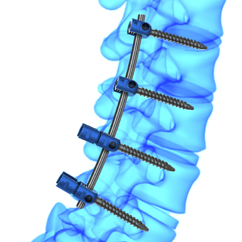 Fuse PSS Pedicle Screw System Fuse Medical
