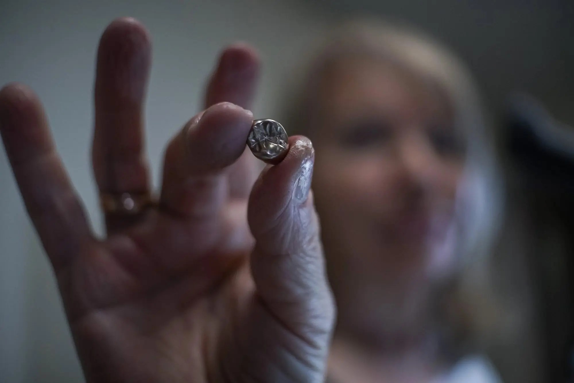 News Fusion Dental Lab