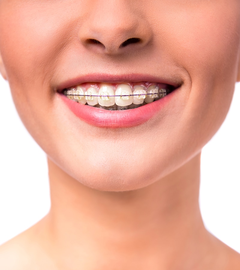 Ortodoncia Clínica Dental Futurdent