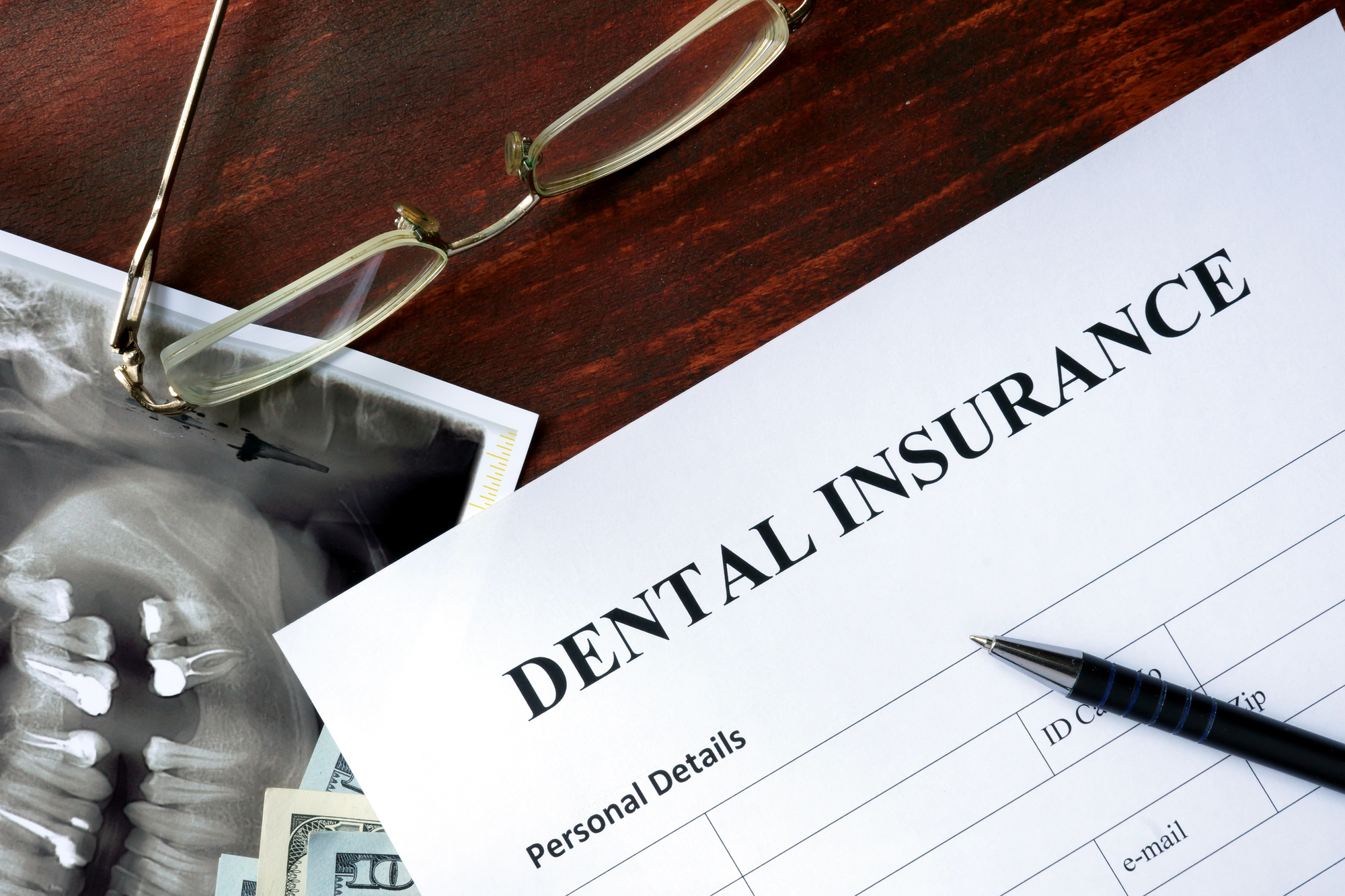 Dental Insurance Cost A Quick Guide FutureWise Insurance